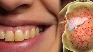 Daily Brush के बाद भी Yellow Teeth होना खतरनाक, Calcium Deficiency से लेकर Liver Damage