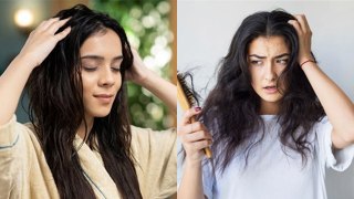 Hair Fall के बीच Oiling करना चाहिए या नहीं, Scalp के हिसाब से Oil लगाने का Routine | Boldsky