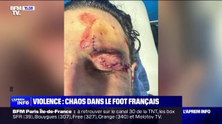 Chaos dans le football français: une violence en hausse
