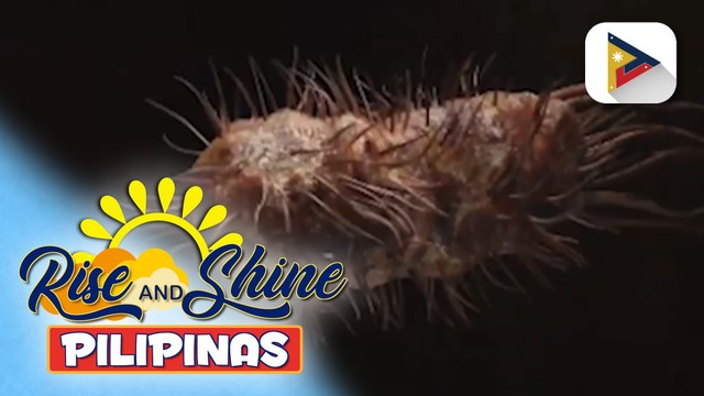 SAY ni DOK | Ano ang sanhi, sintomas at gamut ng Cholera?