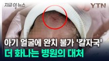 제왕절개 후 딸 얼굴 보고 '깜짝'...병원 대처에 '분노' [지금이뉴스] / YTN