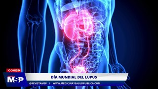 Innovaciones en el manejo y tratamiento del lupus - #ExclusivoMSP