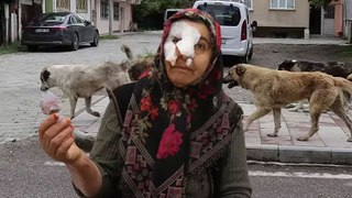 Sokak köpeklerinden kurtulmaya çalışırken düşen kadının burnu ve kolu kırıldı