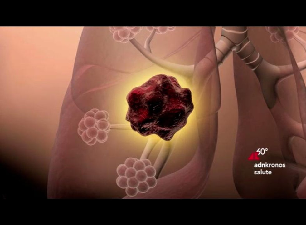 Salute, prevenzione polmonare al centro dell’iniziativa istituzionale al ministero delle Salute