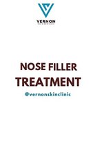 Natural Nose Enhancement with Fillers in Hyderabad | Vernon Skin & Hair