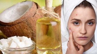 Chehre Par Kapoor Aur Nariyal Ka Tel Lagane Ke Fayde|Coconut Oil & Camphor Benefits For Skin|Boldsky