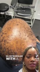 Before and After Results Vid for Dr. Nina Ross!