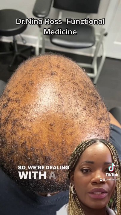 Before and After Results Vid for Dr. Nina Ross!