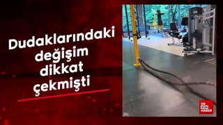 Dudaklarındaki değişim dikkat çekmişti!