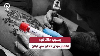 بسبب «التاتو» انتشار مرض خطير في لبنان