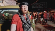 Actor with albinism breaks barriers in Nigeria's Nollywood