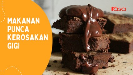 Makanan Punca Kerosakan Gigi