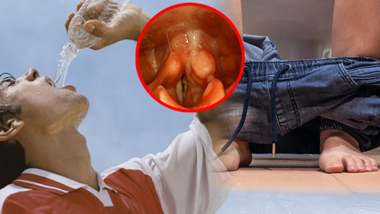 गर्मी में ज्यादा पानी पीने से क्या होता है |Overhydration Side Effects In Hindi |Boldsky