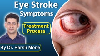 Symptoms Of Eye Stroke Treatment, Instant Relief Tips By Doctor. Harsh Mone|Boldsky