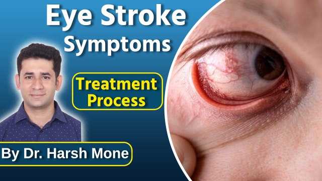 Symptoms Of Eye Stroke Treatment, Instant Relief Tips By Doctor. Harsh Mone|Boldsky