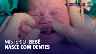 Bebê nasce com dentes e viraliza na web