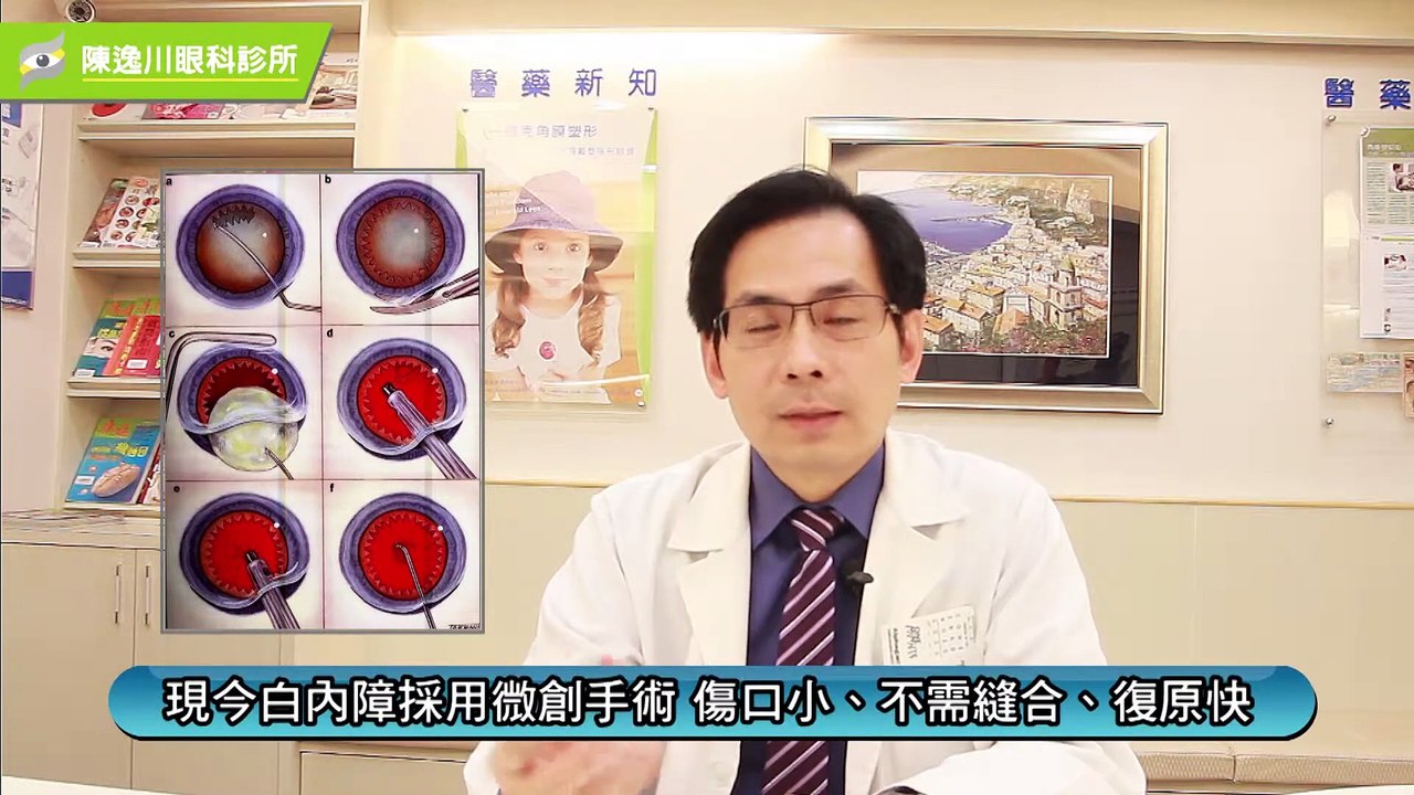 眼科小學堂 - 認識白內障與治療 回復清晰明亮好視力｜陳逸川醫師｜NOW健康