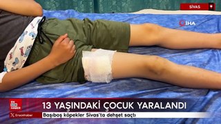 Başıboş köpekler Sivas’ta dehşet saçtı, 13 yaşındaki çocuk yaralandı