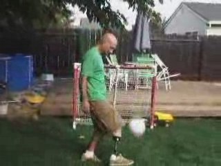 Multimedia  Stumps R Us, an Irreverant Amputee Support Group