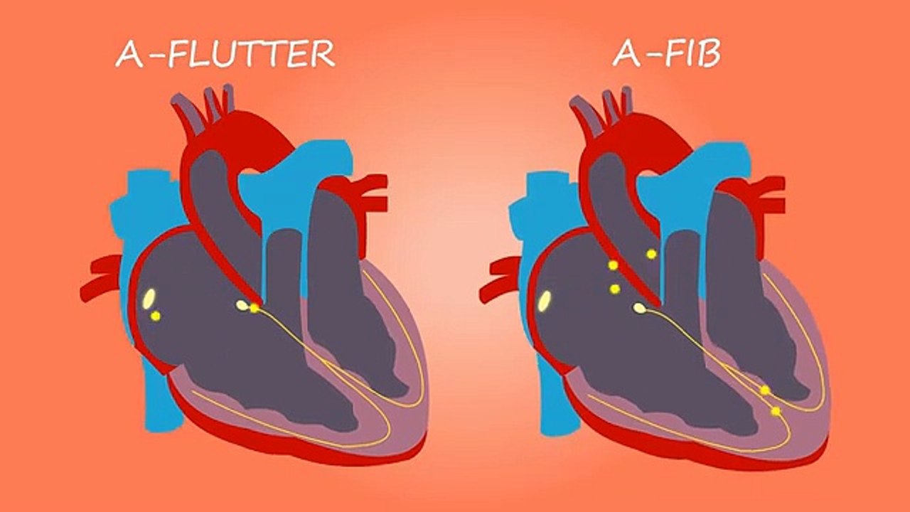 heart-4172