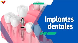 Actitud Saludable | Implantes dentales: un procedimiento que reemplaza las raíces de los dientes