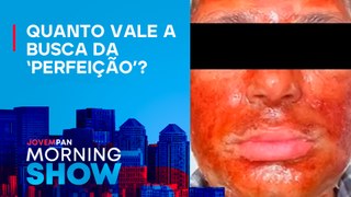 Polícia INVESTIGA MORTE de homem em SP após PROCEDIMENTO ‘peeling de fenol’