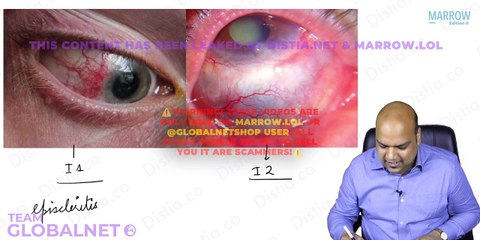 Sclera limbus and ocular routes drug administration anatomy of eye opthalmology
