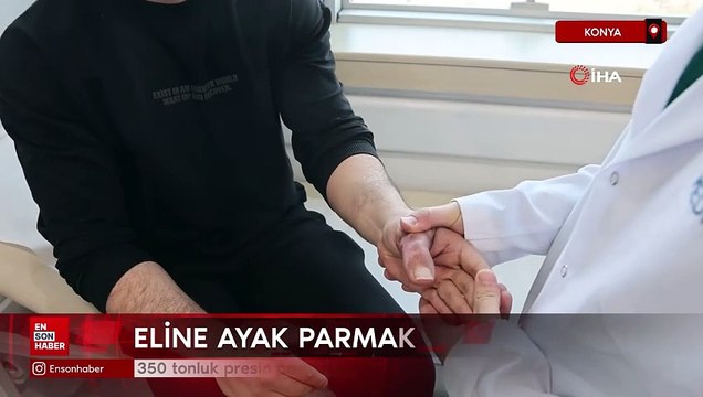 350 tonluk presin parmaklarını kopardığı eline ayak parmakları dikildi