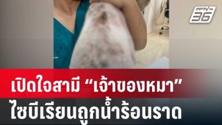 เปิดใจสามี “เจ้าของหมา” ไซบีเรียนถูกน้ำร้อนราด | จับข่าวคุย | 5 มิ.ย. 67