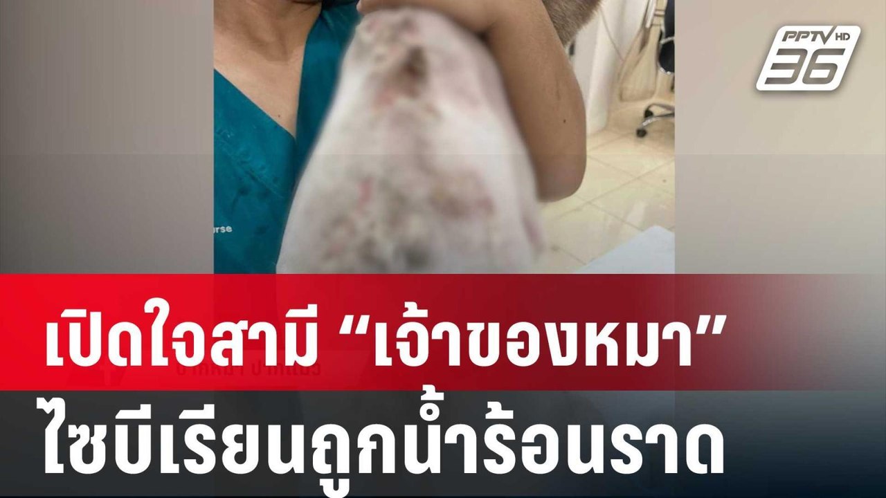 เปิดใจสามี “เจ้าของหมา” ไซบีเรียนถูกน้ำร้อนราด...