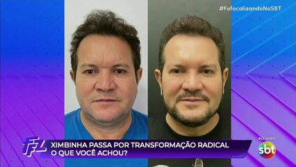 Cariúcha ironiza transformação de Ximbinha: "Qual o antes?"