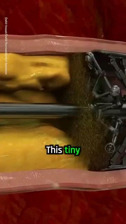 informatic video