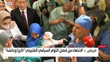 الانتهاء من فصل التوأم السيامي الفلبيني "أكيزا وعائشة" بعد عملية استغرقت 7 ساعات في الرياض