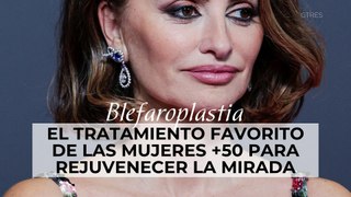 Blefaroplastia: el tratamiento favorito de las mujeres +50 para rejuvenecer la mirada