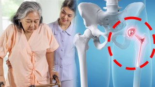 Hip Replacement Surgery Recovery Time: हिप रिप्लेसमेंट के बाद जीवन, रिकवरी टाइम |Boldsky