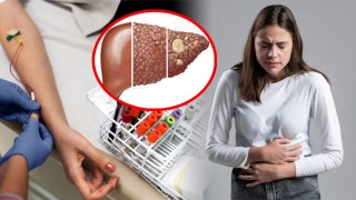 Hemochromatosis Symptoms & Treatment: Body Me Iron Badhne Ke Nuksan, Explained|Boldsky