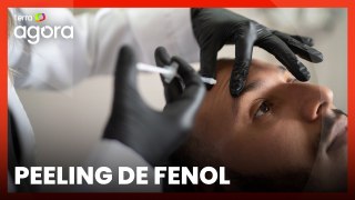 Peeling de fenol: como funciona e quais os riscos do procedimento?