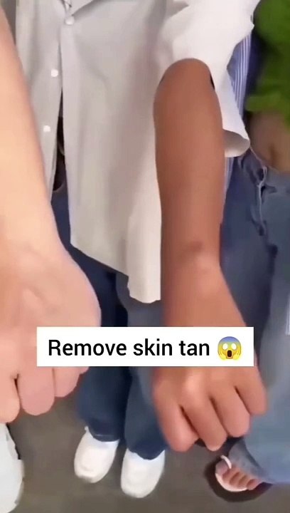 fair skin