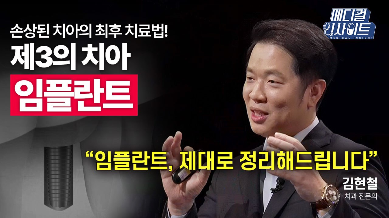 [메디컬 인사이트 35회] 치과 전문의가 알려주는 '임플란트 치료에 대한 오해와 진실...