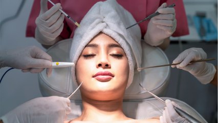 Nicht wiederzuerkennen: Frau mit "größten Wangen der Welt" teilt Throwback-Foto