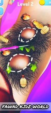 ASMR Removal Dog Ticks & Maggot Infected Armpit | Severely Injured Animation