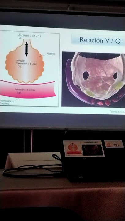 vni wening cnaf casos clinicos y ards 2da parte
