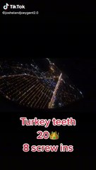 Yurt dışında izlenme rekorları kıran 'Türk dişi' çılgınlığı