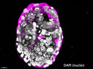 Bilim insanları başardı: Sperm, yumurta ve rahim kullanmadan embriyo modeli geliştirildi