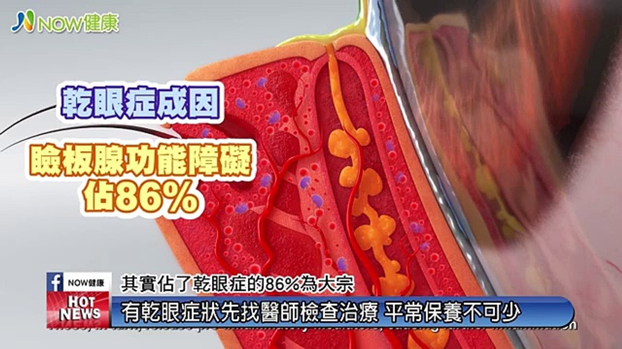 脈衝光不只用來改善皮膚問題 還可以治療缺油型乾眼症｜恩主公醫院 - 新聞影片｜遠大整合行銷