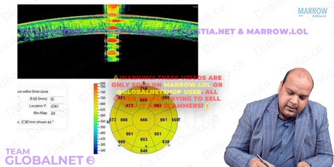 Cornea special investigation yw opthalmology