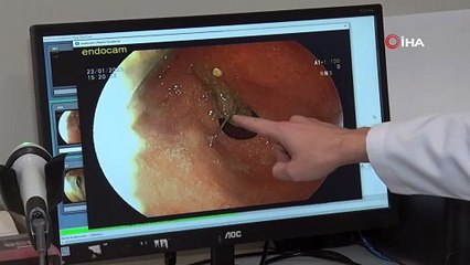 “Ben yandım başkaları yanmasın” Başörtüsünü bağlarken hayatının kâbusunu yaşadı