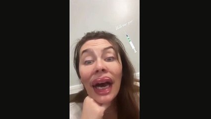 Ünlü oyuncuyu görenler tanıyamadı. Botoks yaptıranlarla dalga geçti
