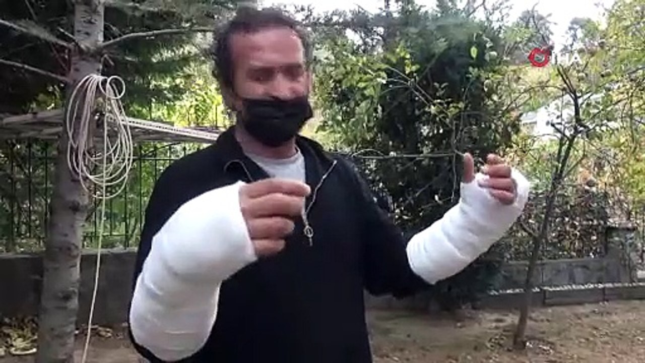Pitbullu saldırıya uğradı...Kolları parçalandı, ölümden döndü