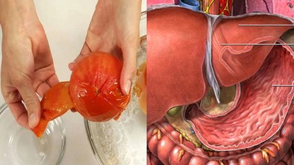 Tomato Peel Good Or Bad: टमाटर का छिलका खाने से पेट में जमा हो जाता है, Expert Advice|Boldsky